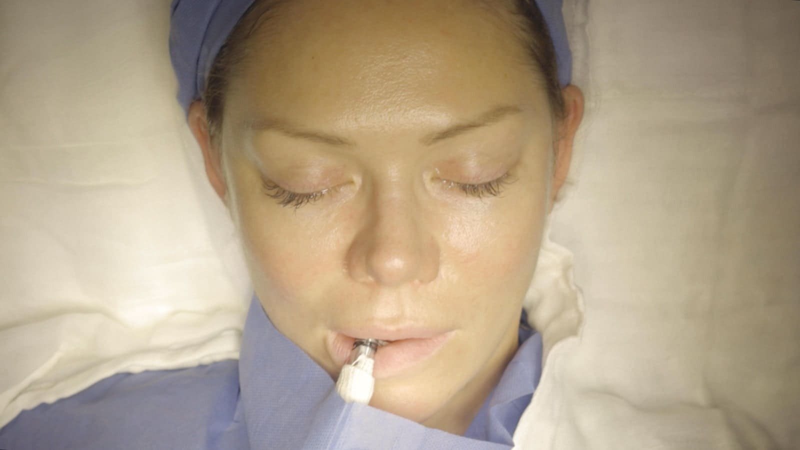 Facelift Cancún Mexico. Dr Patricia Panamá. Plastic Surgeon in Cancún Mexico. Cirujano plastico en Cancún México (1)