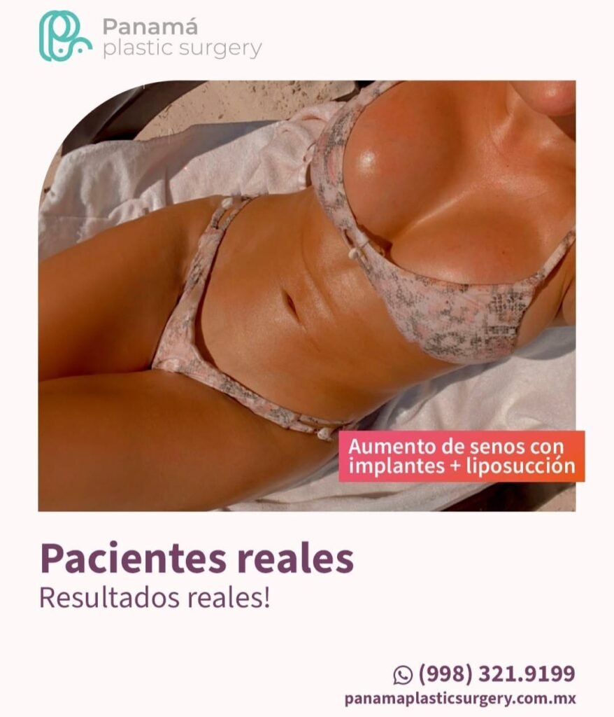 Mommy Makakeover Cancún. Dr Patricia Panamá. Cirujano Plastico en Cancún. Plastic Surgery Cancún (1)