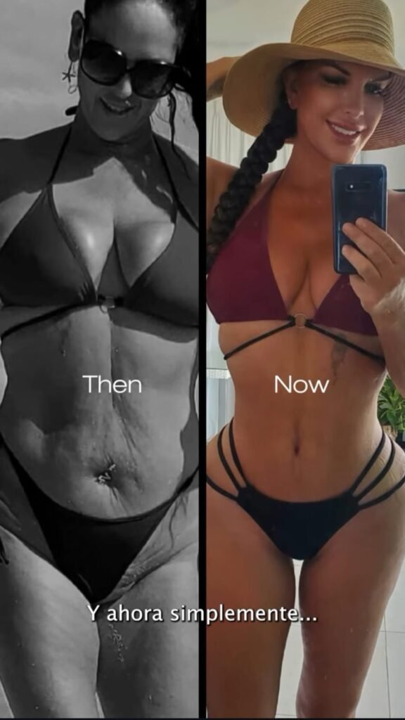 Mommy Makakeover Cancún. Dr Patricia Panamá. Cirujano Plastico en Cancún. Plastic Surgery Cancún